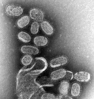 Picture of the influenza virus that infects your body and gives you the flu.