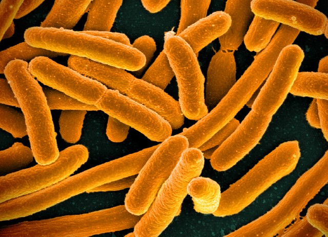 There is currently an E.Coli outbreak in raw meats.